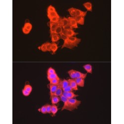 Claudin 3 (CLDN3) Antibody