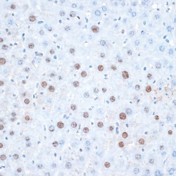 Histone Deacetylase 7 (HDAC7) Antibody