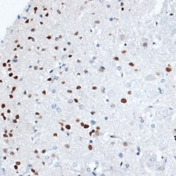 Histone Deacetylase 7 (HDAC7) Antibody