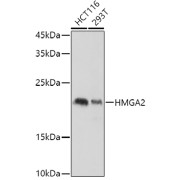 Western blot analysis of various lysates using HMGA2 Antibody at 1/1000 dilution. Secondary antibody: HRP-conjugated Goat anti-Rabbit IgG (H+L) at 1/10000 dilution. Lysates/proteins: 25 µg per lane. Blocking buffer: 3% nonfat dry milk in TBST. Exposure time: 3s.