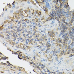 Interleukin 2 Receptor Alpha (IL2RA) Antibody