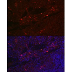 Interleukin 2 Receptor Alpha (IL2RA) Antibody