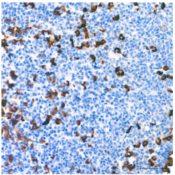 Luteinizing Hormone Beta Polypeptide (LHB) Antibody