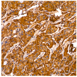 Luteinizing Hormone Beta Polypeptide (LHB) Antibody
