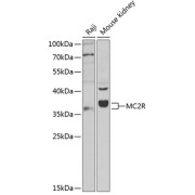 abx002183