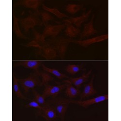 Monocarboxylate Transporter 1 (SLC16A1) Antibody