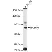 Western blot analysis of various lysates using SLC16A4 Antibody at 1/1000 dilution. Secondary antibody: HRP-conjugated Goat anti-Rabbit IgG (H+L) at 1/10000 dilution. Lysates/proteins: 25 µg per lane. Blocking buffer: 3% nonfat dry milk in TBST. Exposure time: 10s.