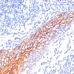 Cadherin-1 (CDH1) Antibody