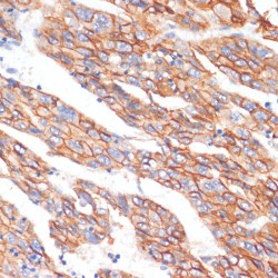 Cadherin-1 (CDH1) Antibody
