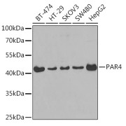 Western blot analysis of various lysates using PAR4 Antibody at 1/400 dilution. Secondary antibody: HRP-conjugated Goat anti-Rabbit IgG (H+L) at 1/10000 dilution. Lysates/proteins: 25 µg per lane. Blocking buffer: 3% nonfat dry milk in TBST. Exposure time: 30s.