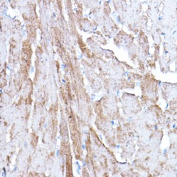 Pyruvate Dehydrogenase Kinase Isozyme 4 (PDK4) Antibody