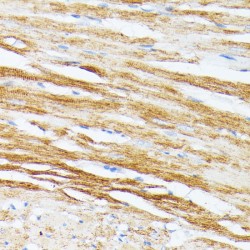 Tropomyosin Beta Chain (TPM2) Antibody