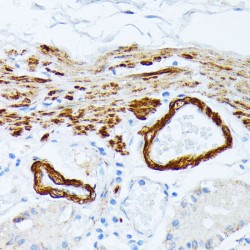 Tropomyosin Beta Chain (TPM2) Antibody