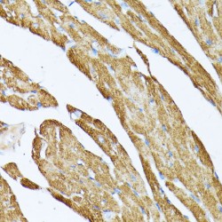 Tropomyosin Beta Chain (TPM2) Antibody