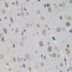 Small Ubiquitin-Related Modifier 3 (SUMO3) Antibody
