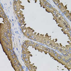 Small Ubiquitin-Related Modifier 3 (SUMO3) Antibody