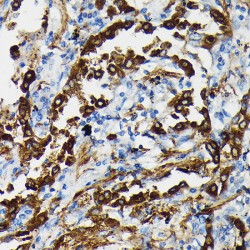 Pulmonary Surfactant-Associated Protein A1 (SFTPA1) Antibody