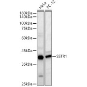 abx002251