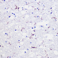 Allograft Inflammatory Factor 1 (AIF1) Antibody