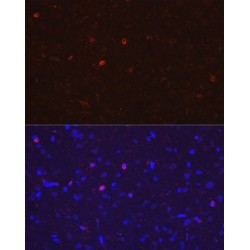 Allograft Inflammatory Factor 1 (AIF1) Antibody