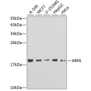 Western blot analysis of various lysates using ARF6 Antibody at 1/200 dilution. Secondary antibody: HRP-conjugated Goat anti-Rabbit IgG (H+L) at 1/10000 dilution. Lysates/proteins: 25 µg per lane. Blocking buffer: 3% nonfat dry milk in TBST.