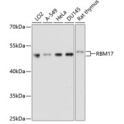 Western blot analysis of various lysates using RBM17 Antibody at 1/1000 dilution. Secondary antibody: HRP-conjugated Goat anti-Rabbit IgG (H+L) at 1/10000 dilution. Lysates/proteins: 25 µg per lane. Blocking buffer: 3% nonfat dry milk in TBST. Exposure time: 30s.