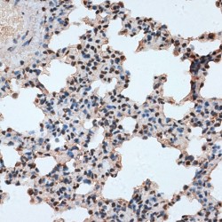 RNA Binding Motif Protein 17 (RBM17) Antibody