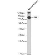 Western blot analysis of lysates from mouse kidney, using PAK1 Antibody at 1/700 dilution. Secondary antibody: HRP-conjugated Goat anti-Rabbit IgG (H+L) at 1/10000 dilution. Lysates/proteins: 25 µg per lane. Blocking buffer: 3% nonfat dry milk in TBST.