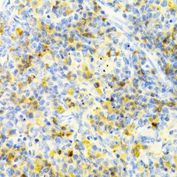 Serine/threonine-Protein Kinase PAK 1 (PAK1) Antibody