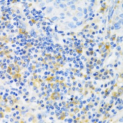 Serine/threonine-Protein Kinase PAK 1 (PAK1) Antibody