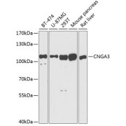 Western blot analysis of various lysates using CNGA3 Antibody at 1/1000 dilution. Secondary antibody: HRP-conjugated Goat anti-Rabbit IgG (H+L) at 1/10000 dilution. Lysates/proteins: 25 µg per lane. Blocking buffer: 3% nonfat dry milk in TBST. Exposure time: 30s.