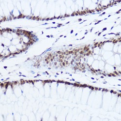 Histone H1.0 (H1F0) Antibody