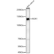 Western blot analysis of lysates from Rat uterus, using ROR1 Antibody at 1/800 dilution. Secondary antibody: HRP-conjugated Goat anti-Rabbit IgG (H+L) at 1/10000 dilution. Lysates/proteins: 25 µg per lane. Blocking buffer: 3% nonfat dry milk in TBST. Exposure time: 90s.