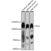 Western blot analysis of various lysates using PLG Antibody at 1/1000 dilution. Secondary antibody: HRP-conjugated Goat anti-Rabbit IgG (H+L) at 1/10000 dilution. Lysates/proteins: 25 µg per lane. Blocking buffer: 3% nonfat dry milk in TBST. Exposure time: 1s.