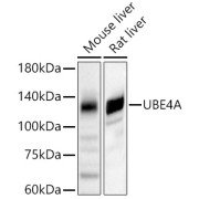 Western blot analysis of various lysates, using UBE4A Antibody at 1/3000 dilution. Secondary antibody: HRP-conjugated Goat anti-Rabbit IgG (H+L) at 1/10000 dilution. Lysates/proteins: 25 µg per lane. Blocking buffer: 3% nonfat dry milk in TBST. Exposure time: 60s.