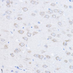 Ubiquitin Conjugation Factor E4 A (UBE4A) Antibody
