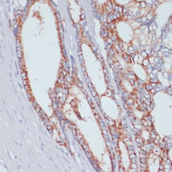 Zinc Transporter ZIP4 (SLC39A4) Antibody