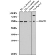 Western blot analysis of various lysates using GABPB2 Antibody at 1/1000 dilution. Secondary antibody: HRP-conjugated Goat anti-Rabbit IgG (H+L) at 1/10000 dilution. Lysates/proteins: 25 µg per lane. Blocking buffer: 3% nonfat dry milk in TBST. Exposure time: 30s.