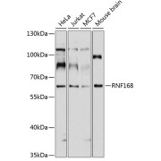 Western blot analysis of various lysates using RNF168 Antibody at 1/1000 dilution. Secondary antibody: HRP-conjugated Goat anti-Rabbit IgG (H+L) at 1/10000 dilution. Lysates/proteins: 25 µg per lane. Blocking buffer: 3% nonfat dry milk in TBST. Exposure time: 10s.