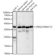 Western blot analysis of various lysates, using STING/TMEM173 Antibody at 1/400 dilution. Secondary antibody: HRP-conjugated Goat anti-Rabbit IgG (H+L) at 1/10000 dilution. Lysates/proteins: 25 µg per lane. Blocking buffer: 3% nonfat dry milk in TBST. Exposure time: 1s.