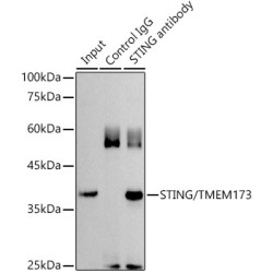 Stimulator of Interferon Genes Protein / TMEM173 (STING1) Antibody