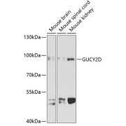 Western blot analysis of various lysates using GUCY2D Antibody at 1/1000 dilution. Secondary antibody: HRP-conjugated Goat anti-Rabbit IgG (H+L) at 1/10000 dilution. Lysates/proteins: 25 µg per lane. Blocking buffer: 3% nonfat dry milk in TBST. Exposure time: 90s.