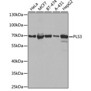 Western blot analysis of various lysates using PLS3 Antibody at 1/1000 dilution. Secondary antibody: HRP-conjugated Goat anti-Rabbit IgG (H+L) at 1/10000 dilution. Lysates/proteins: 25 µg per lane. Blocking buffer: 3% nonfat dry milk in TBST. Exposure time: 10s.