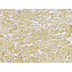 Aconitate Hydratase, Mitochondrial (ACO2) Antibody