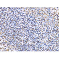 Aconitate Hydratase, Mitochondrial (ACO2) Antibody