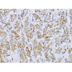 Aconitate Hydratase, Mitochondrial (ACO2) Antibody