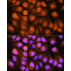 ATPase GET3 (GET3) Antibody
