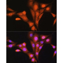 ATPase GET3 (GET3) Antibody