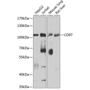 Western blot analysis of various lysates using CD97 Antibody at 1/1000 dilution. Secondary antibody: HRP-conjugated Goat anti-Rabbit IgG (H+L) at 1/10000 dilution. Lysates/proteins: 25 µg per lane. Blocking buffer: 3% nonfat dry milk in TBST. Exposure time: 90s.