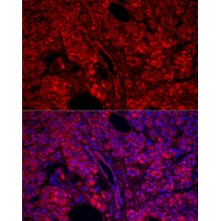 Carboxypeptidase A1 (CPA1) Antibody